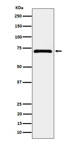 WB - EPHX2 Antibody AP92925